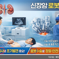 신장암 로봇수술